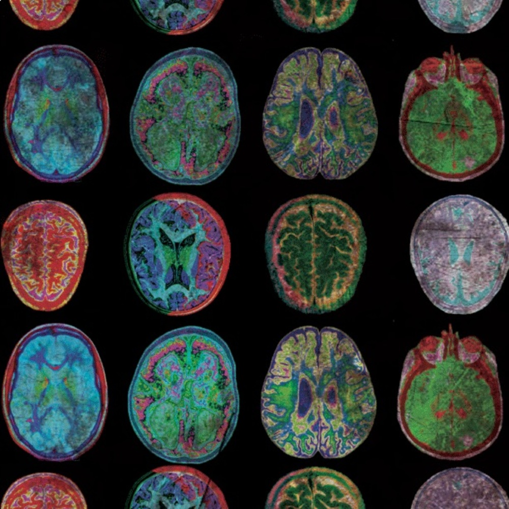 Meet your Posher, Wyatt